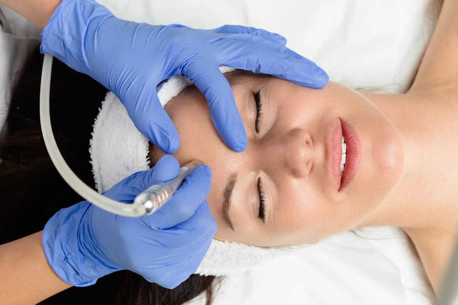 Yvonne Hefft - Kosmetikstudio - MICRODERMABRASION